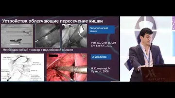 Сложный таз – особенности хирургии